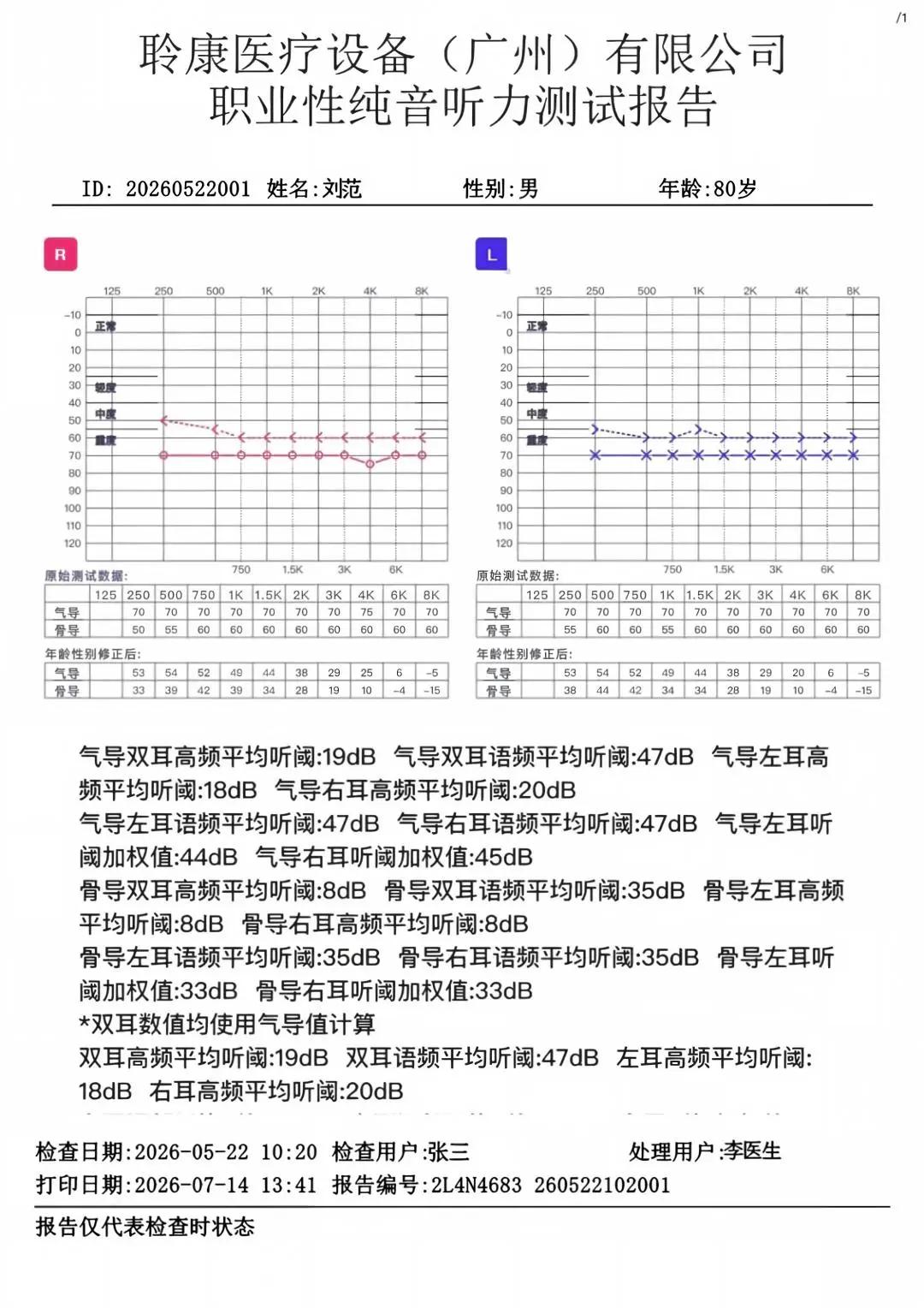 GB 23466?2025新國標實施｜職業(yè)聽力健康守護刻不容緩(圖3)